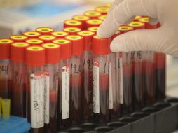 La ONU se ha plantado un riguroso plan para mermar las cifras de la enfermadad. ARCHIVO / EFE