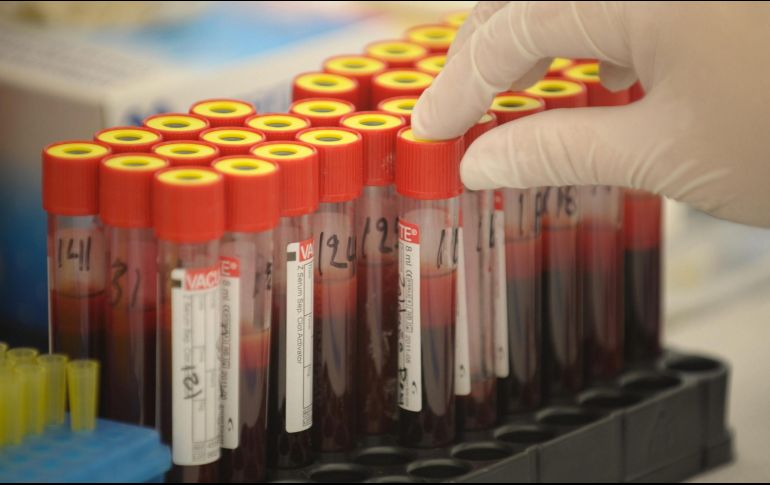 La ONU se ha plantado un riguroso plan para mermar las cifras de la enfermadad. ARCHIVO / EFE