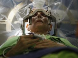 Tal avance podría beneficiar a las personas con parálisis, lesiones de médula espinal, enfermedades neurodegenerativas u otras afecciones que impiden el habla. EL INFORMADOR / ARCHIVO