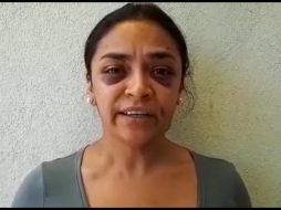 La CNDH solicitó medidas cautelares para salvaguardar la integridad de la reportera, quien presentaba golpes. TWITTER / @Apeg_colectivo