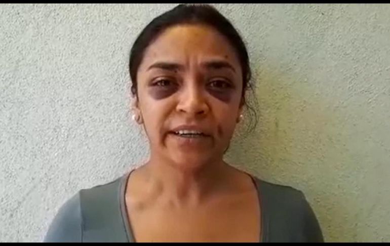 La CNDH solicitó medidas cautelares para salvaguardar la integridad de la reportera, quien presentaba golpes. TWITTER / @Apeg_colectivo