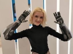 Sus prótesis fueron aprobadas clínicamente y son livianas y accesibles. TWITTER / @art2gee