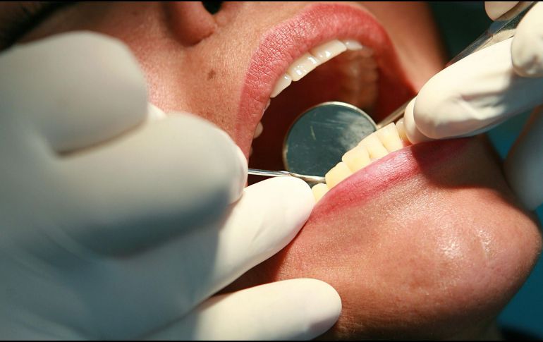 En la boca existen unas 100 millones de bacterias por cada mililitro de saliva y si no se controlan a tiempo, pueden ingresar al torrente sanguíneo y afectar otras partes del cuerpo. EL INFORMADOR / ARCHIVO