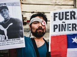 Diversos ciudadanos han recibido disparos en el rostro. AFP