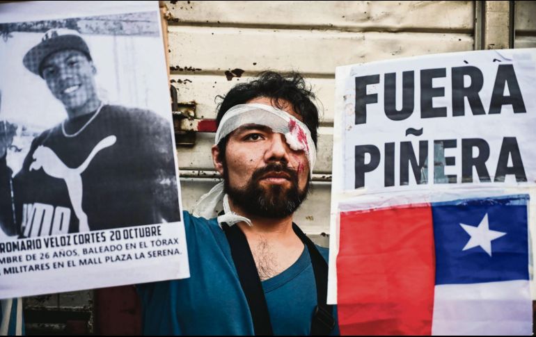 Diversos ciudadanos han recibido disparos en el rostro. AFP