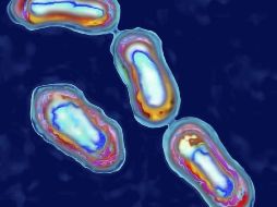 La peste está causada por la bacteria Yersinia pestis. GETTY IMAGES