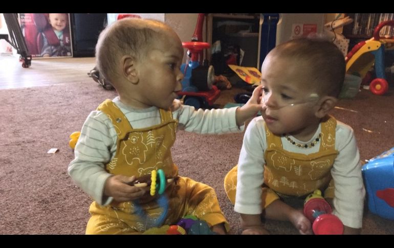 Deiniol (derecha) ya está en casa, pero todavía necesita oxígeno.