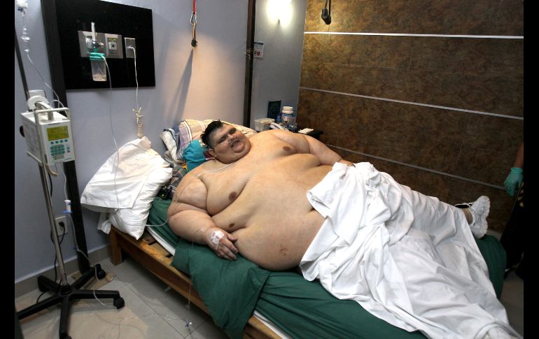 El 9 de mayo de 2017, previo a someterse a la primera operación en Jalisco. El equipo médico lo sometió previamente a dieta y ejercicio. EFE/ARCHIVO