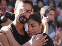 Al presentar su nuevo balance, el INDH precisó que de las 241 personas con heridas oculares, 161 corresponden a trauma ocular, 73 con lesión ocular, cinco con pérdida ocular y dos casos presentaron estallido ocular. EFE/ E. González