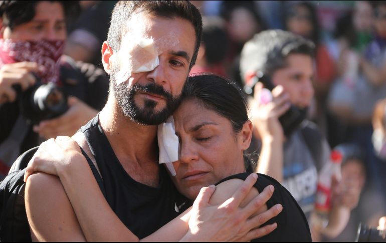 Al presentar su nuevo balance, el INDH precisó que de las 241 personas con heridas oculares, 161 corresponden a trauma ocular, 73 con lesión ocular, cinco con pérdida ocular y dos casos presentaron estallido ocular. EFE/ E. González