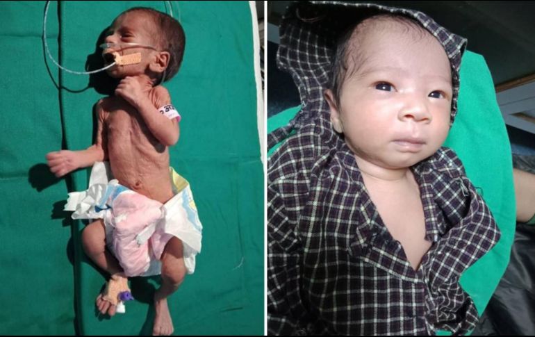 La bebé fue llevada al hospital en estado crítico, pero ahora está saludable. Dr Ravi Khanna