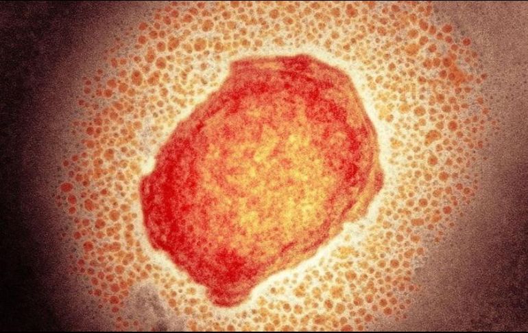 La viruela de los monos, también llamada viruela del simio o símica, es causada por un virus similar al de la viruela humana. SCIENCE PHOTO LIBRARY