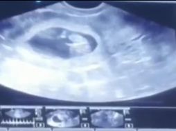 En el video se aprecian los movimientos del bebé mientras suena la canción 