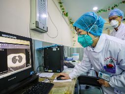 Personal médico observa una imagen del pulmón de un paciente en un hospital en Wuhan, China. AFP/ARCHIVO