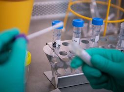 Una prueba de laboratorio confirma o descarta la presencia del coronavirus. AFP/DPA/ARCHIVO