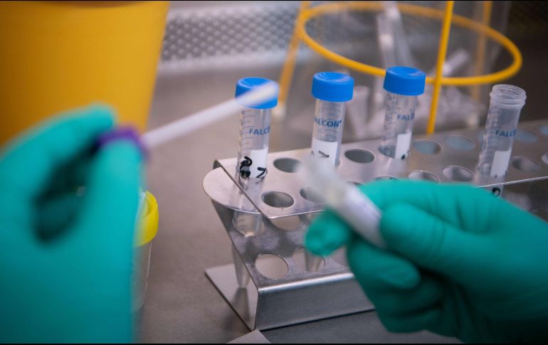 Una prueba de laboratorio confirma o descarta la presencia del coronavirus. AFP/DPA/ARCHIVO