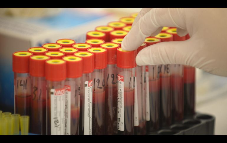 Científicos trabajan para identificar desde el momento del diagnóstico a los enfermos que podrían controlar el virus por sí solas. EFE/Archivo