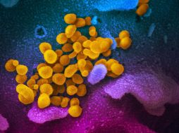 Imagen microscópica del SARS-CoV-2 (amarillo). El coronavirus es detectable en el aire hasta tres horas. EFE/NIH/ARCHIVO