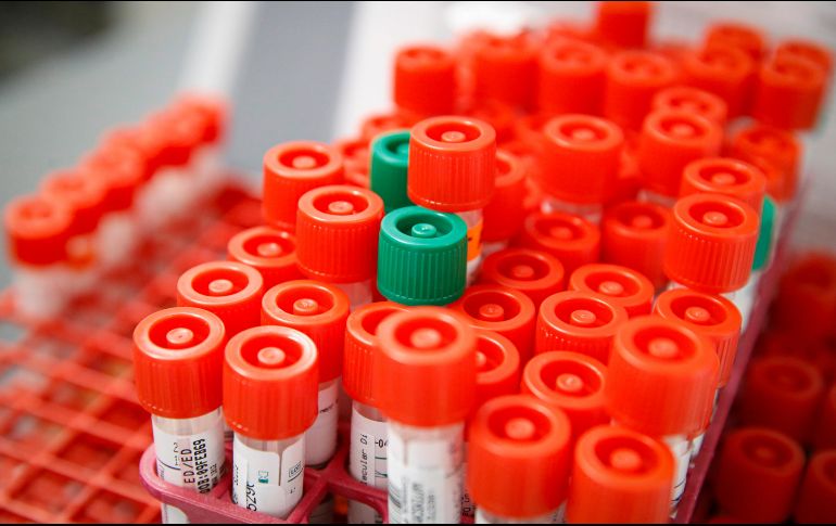 18 pruebas se encuentran en proceso en el laboratorio estatal de salud pública en espera de confirmar o rechazar más casos positivos. AP / J. Minchillo