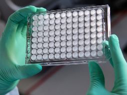 La mayor concentración de casos sospechosos se registra en Guadalajara con 59, Zapopan 47, Tlaquepaque con siete y Tonalá con cuatro. AP / S. Hoppe