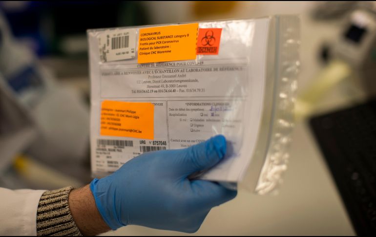 Ayer jueves informaron que la empresa a la cual le solicitaron 20 mil pruebas rápidas para la detección de COVID-19, canceló la compra. AP / F. Seco