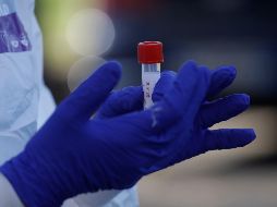 La autorización de las pruebas Xpert Xpress SARS-CoV-2, permite que sean utilizadas en una emergencia, cuando no existan alternativas adecuadas, aprobadas y disponibles. AP / A. Tarantino