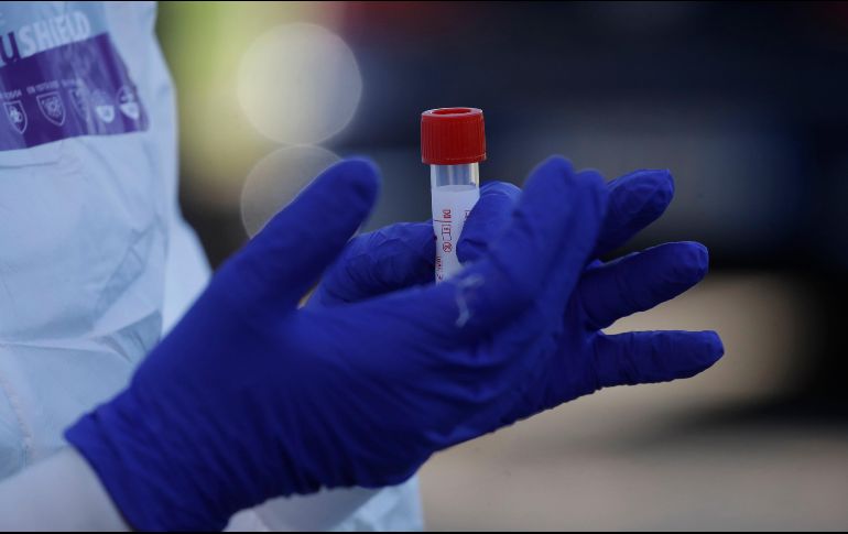 La autorización de las pruebas Xpert Xpress SARS-CoV-2, permite que sean utilizadas en una emergencia, cuando no existan alternativas adecuadas, aprobadas y disponibles. AP / A. Tarantino