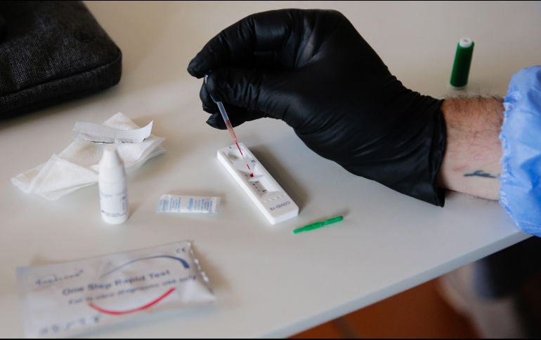 Las pruebas de la Unidad de Patología Clínica tienen la misma validez que las que se realizan en el Laboratorio Estatal de la Secretaría de Salud Jalisco y el Hospital Civil Dr. Juan I. Menchaca. EFE/T. Petinga