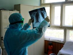 La hidroxicloroquina es un derivado del antipalúdico cloroquina, cuya eficacia es objeto de debate mundial. EFE / ESPECIAL