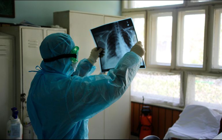 La hidroxicloroquina es un derivado del antipalúdico cloroquina, cuya eficacia es objeto de debate mundial. EFE / ESPECIAL