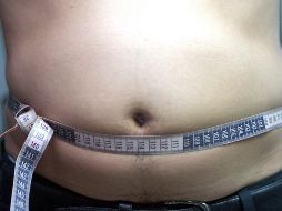 La hipertensión y la obesidad están presentes en dos de cada 10 pacientes con coronavirus en la Ciudad de México, que tiene más casos de COVID-19, de los cuales 49% padece además otra enfermedad. EL INFORMADOR / ARCHIVO