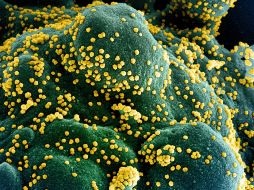 Los criterios del ensayo permiten el tratamiento de pacientes en una etapa temprana, evitando que la infección avance y sea necesaria la intubación. EFE / EPA / NIAID /National Institutes of Health