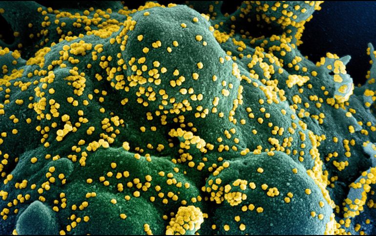 Los criterios del ensayo permiten el tratamiento de pacientes en una etapa temprana, evitando que la infección avance y sea necesaria la intubación. EFE / EPA / NIAID /National Institutes of Health