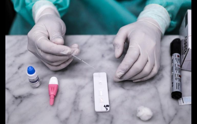 Señalan que no se trata de pruebas diagnósticas para identificar a enfermos de COVID-19, sino de test rápidos que detectan anticuerpos. EFE/J. Ronroconi