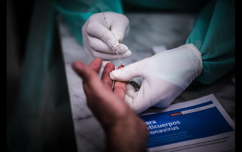 Señalan que no se trata de pruebas diagnósticas para identificar a enfermos de COVID-19, sino de test rápidos que detectan anticuerpos. EFE/J. Ronroconi