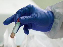 Además de revisión de temperatura corporal, se usarían tests de diagnóstico del coronavirus. AP/ARCHIVO