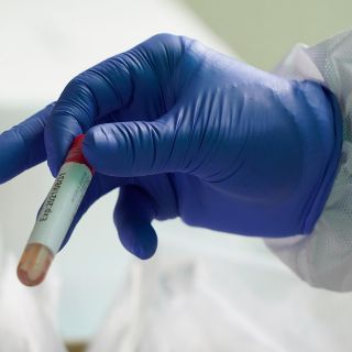 Una persona contagia coronavirus a 533 trabajadores en Ghana