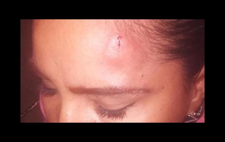 La lesionada presentaba un hematoma en la parte frontal izquierda, así como una herida de forma vertical de unos dos centímetros de magnitud. ESPECIAL