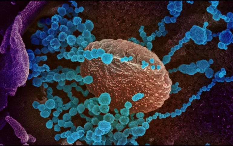 Aún se requiere mayor investigación para determinar si el SARS-CoV-2 puede transmitirse por vía sexual. EFE//NIAID- RML/NIH/ARCHIVO