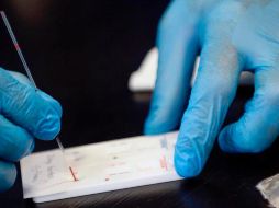 Oxford y AstraZeneca firmaron un acuerdo que, si se confirma la eficacia de la vacuna, podría permitir fabricar entre 30 millones y 100 millones de dosis en el RU para septiembre. EFE / ARCHIVO