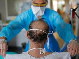 Cerca del 50% de los pacientes diagnosticados con covid-19 han experimentado problemas neurológicos. REUTERS