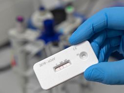 En Jalisco se realizan mil 500 pruebas diarias (entre rápidas y PCR). AP /ARCHIVO