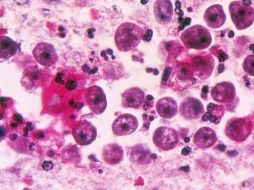 La ameba entra al organismo por la nariz y de allí migra hacia el cerebro. SCIENCE PHOTO LIBRARY