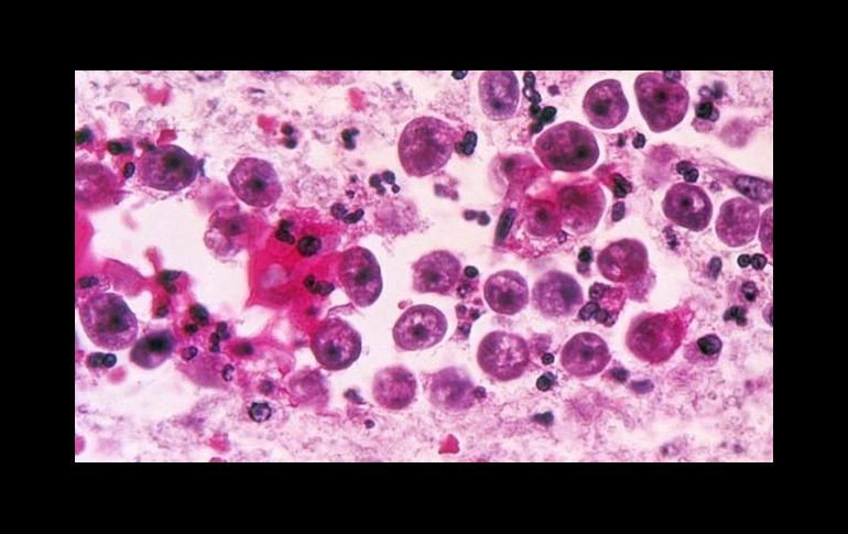 La ameba entra al organismo por la nariz y de allí migra hacia el cerebro. SCIENCE PHOTO LIBRARY