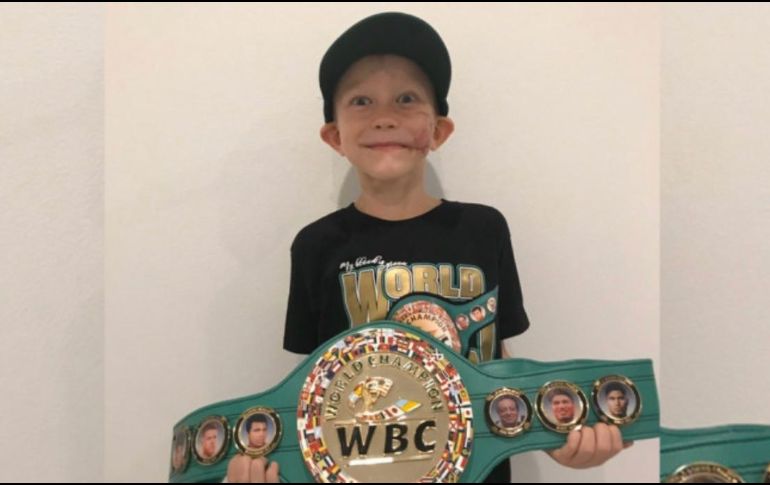 El niño de seis años terminó con graves heridas en su rostro. TWITTER/@WBCBoxing