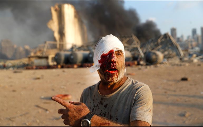 El ministro de Sanidad libanés, Hamad Hasan, ha ordenado a todos los hospitales que reciban a los heridos. AP / H. Malla