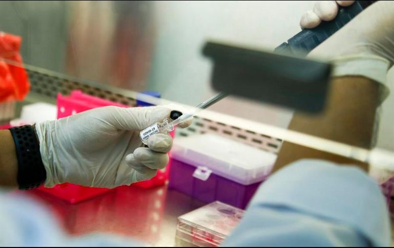 Los investigadores analizaron una base de datos de 159 pacientes con lupus y artritis y que también presentaban COVID-19. EFE/ARCHIVO