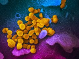 Virólogos no quieren alarmar mientras estas reinfecciones de SARS-CoV-2 solo sean casos aislados. EFE/NIH/ARCHIVO