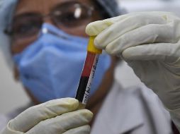 En la entidad, 123 de los 125 municipios han presentado casos de COVID-19. EFE/ARCHIVO