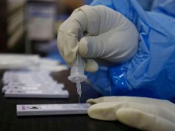 Se trata de la primera prueba de este tipo en Italia, y tras su u aprobación por el Ministerio de Sanidad ya está lista para entrar en producción. EFE / F. Khan